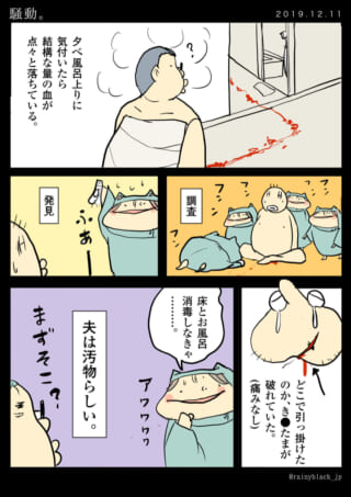 入浴後に流血を発見し調査。
