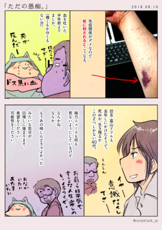 蚊に刺された免疫反応の漫画。